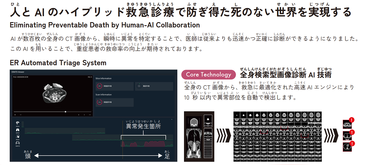 救急外傷のCT診断課題をAIで解決する技術を開発